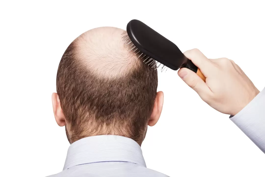 In bold and treatment with a zxcvbnmqwert spray